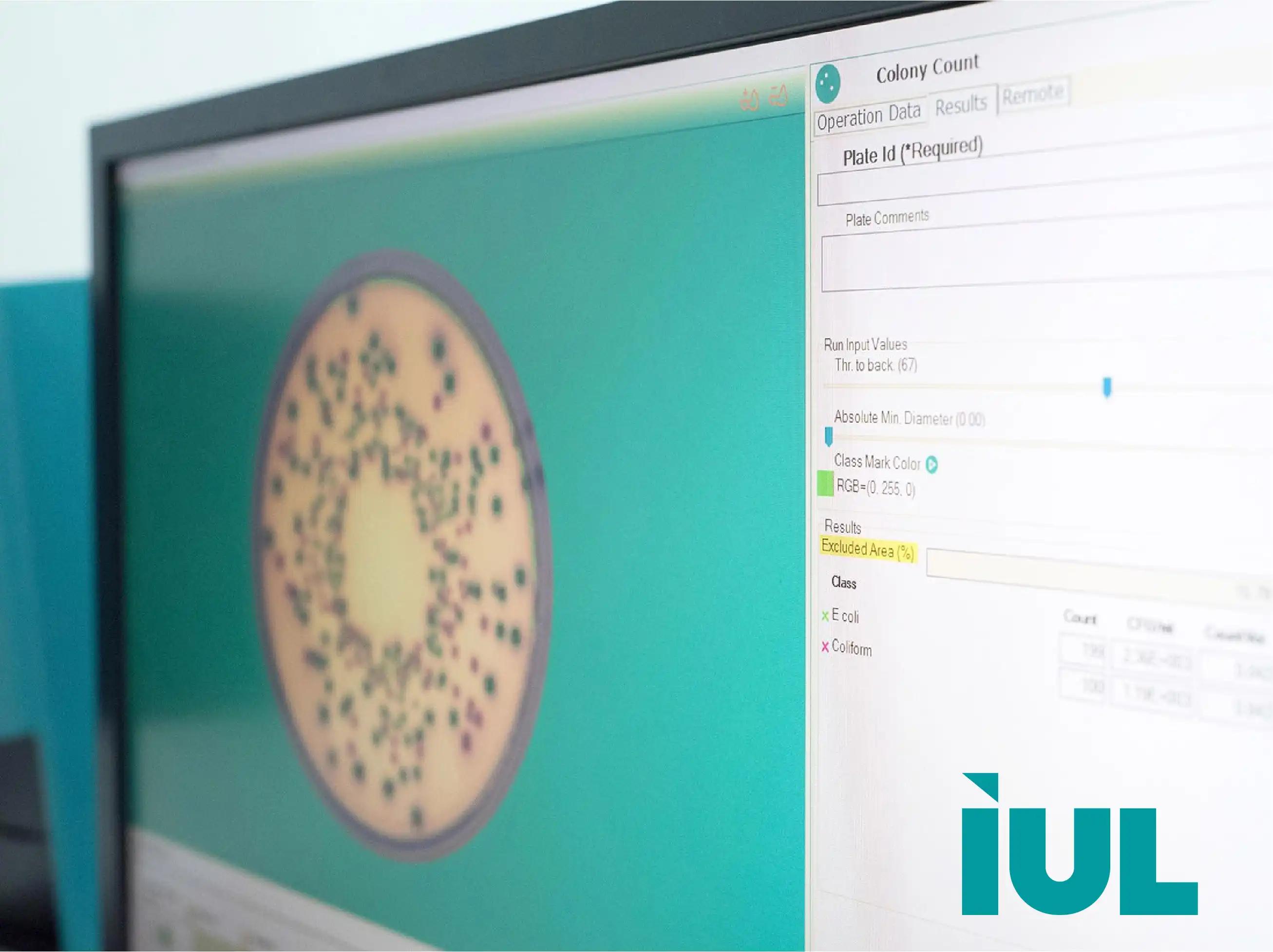 IUL Colony Counting & Zone Reading